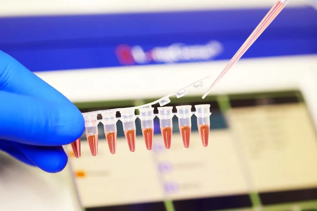 PCR/qPCR उपभोग्य वस्तू कशी निवडावी?